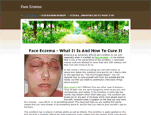 Tablet Screenshot of faceeczemainfo.weebly.com