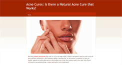 Desktop Screenshot of getridofacne-naturally.weebly.com