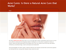 Tablet Screenshot of getridofacne-naturally.weebly.com