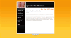 Desktop Screenshot of liposuctionutah.weebly.com