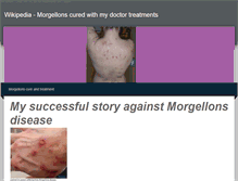 Tablet Screenshot of morgellonss.weebly.com